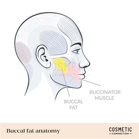 buccal fettpute|The Surgical Anatomy and the Deep Plane Thread Lift of the Buccal Fat .